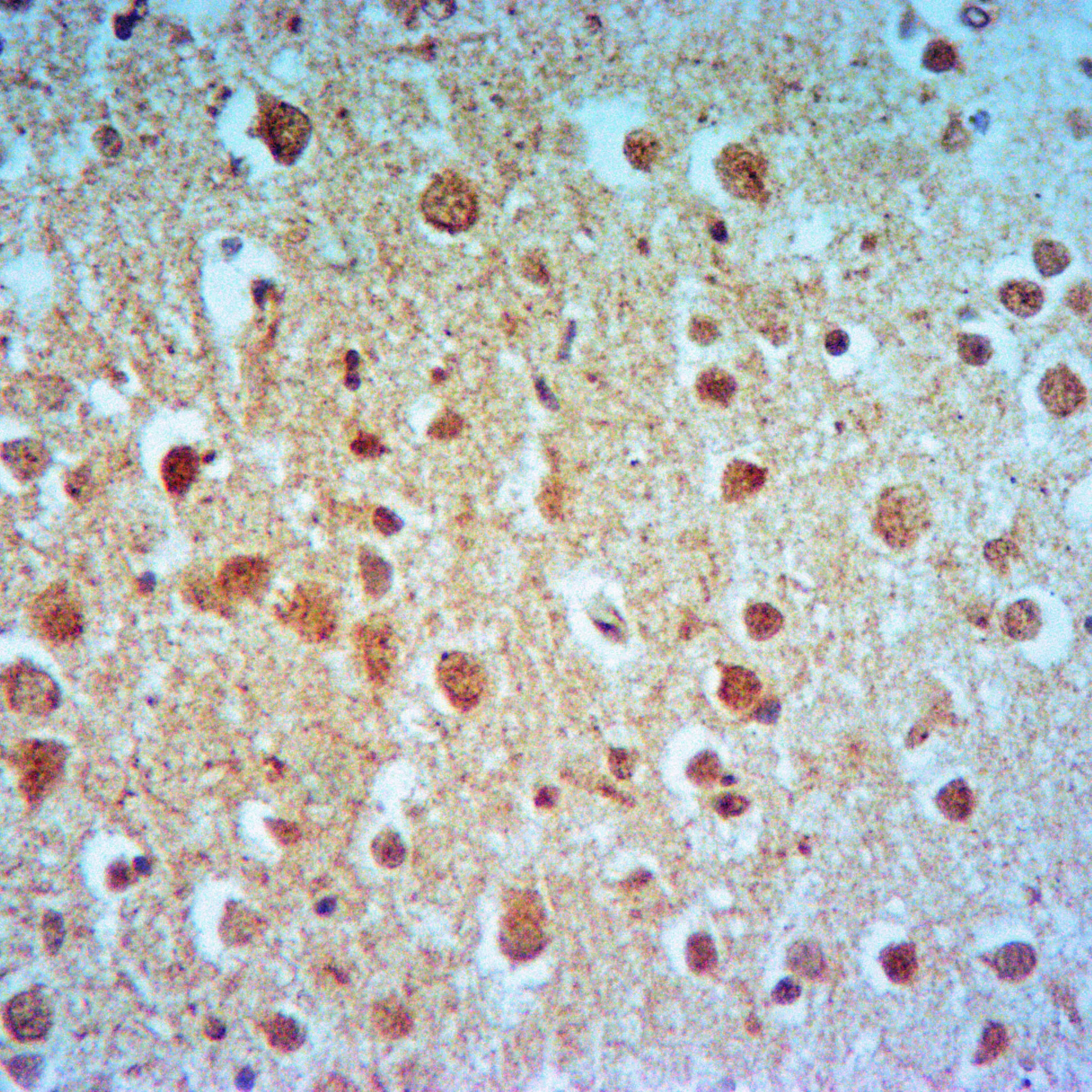 splicing factor 1 (SF1) Rabbit Polyclonal Antibody - image 1