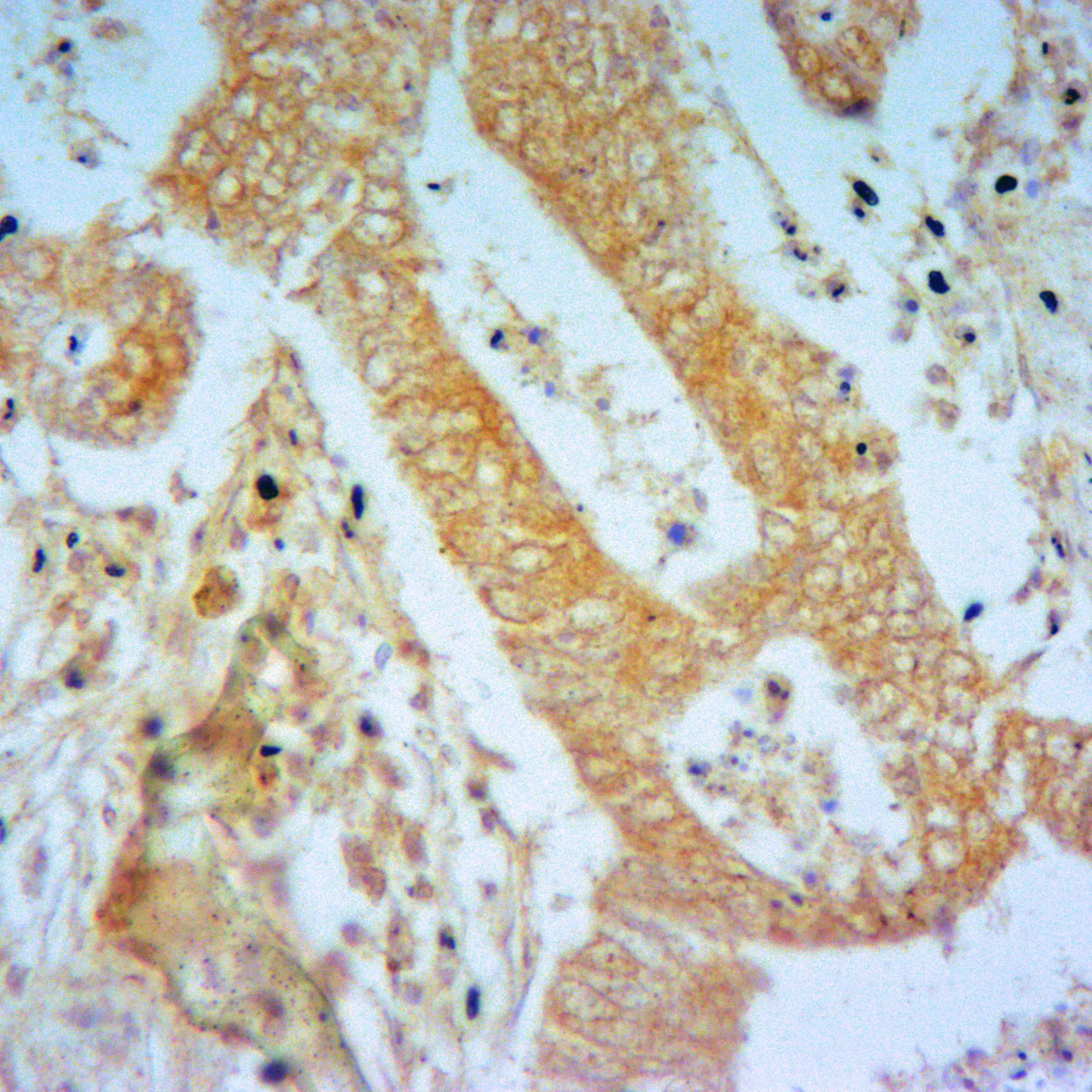 ITLN1 Rabbit Polyclonal Antibody - image 1