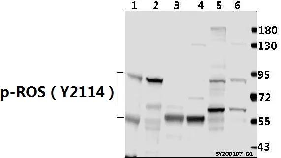 ROS1 Rabbit Polyclonal Antibody - image 1