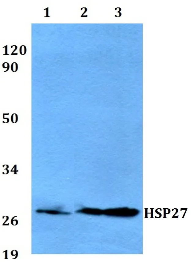 HSP27 (HSPB1) Rabbit Polyclonal Antibody - image 1
