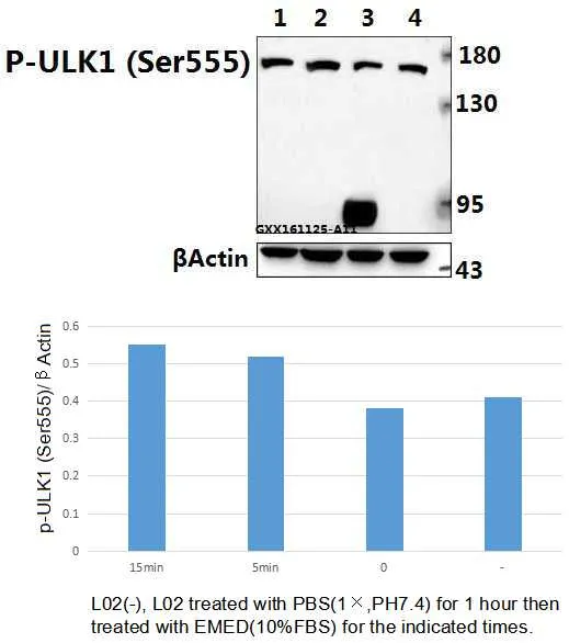 ULK1 Rabbit Polyclonal Antibody - image 1