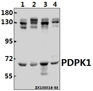 PDPK1 Rabbit Polyclonal Antibody - image 1