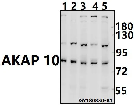 AKAP10 Rabbit Polyclonal Antibody - image 1