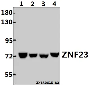 ZNF23 Rabbit Polyclonal Antibody - image 1
