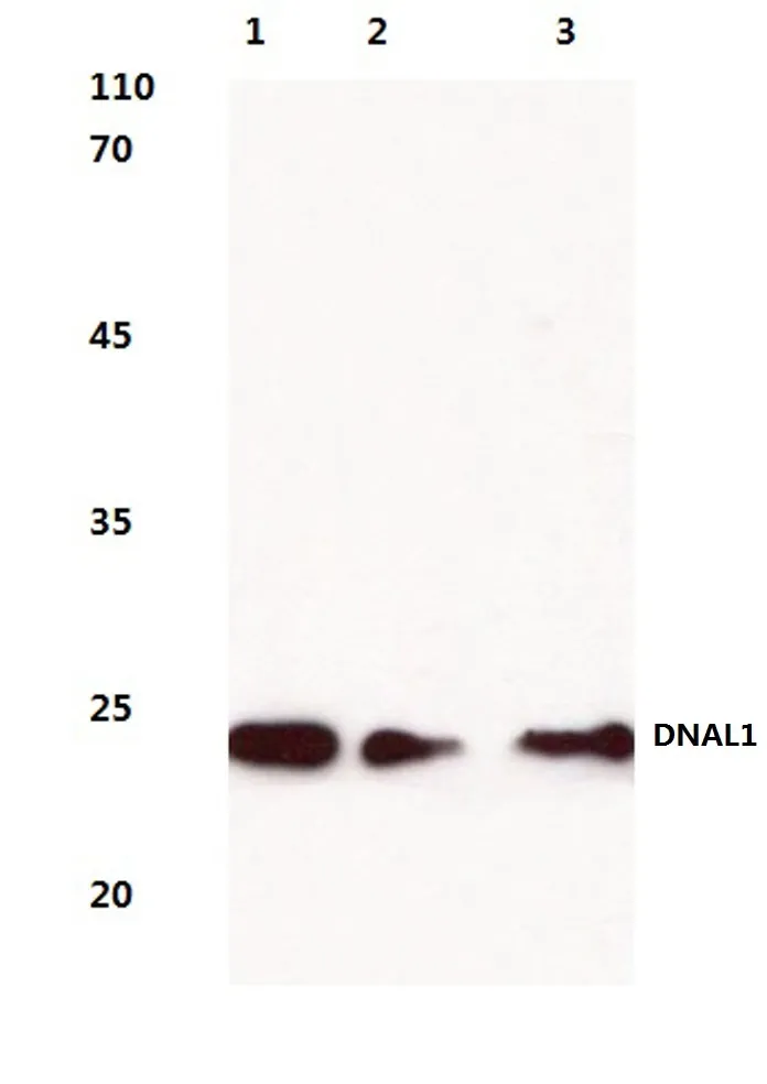 DNAL1 Rabbit Polyclonal Antibody - image 1