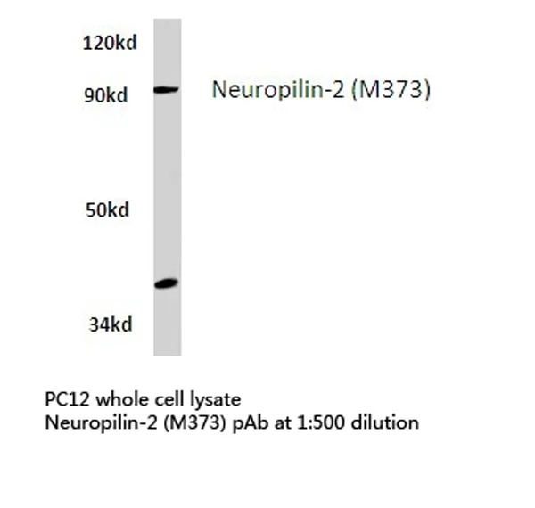 NRP2 Rabbit Polyclonal Antibody - image 1