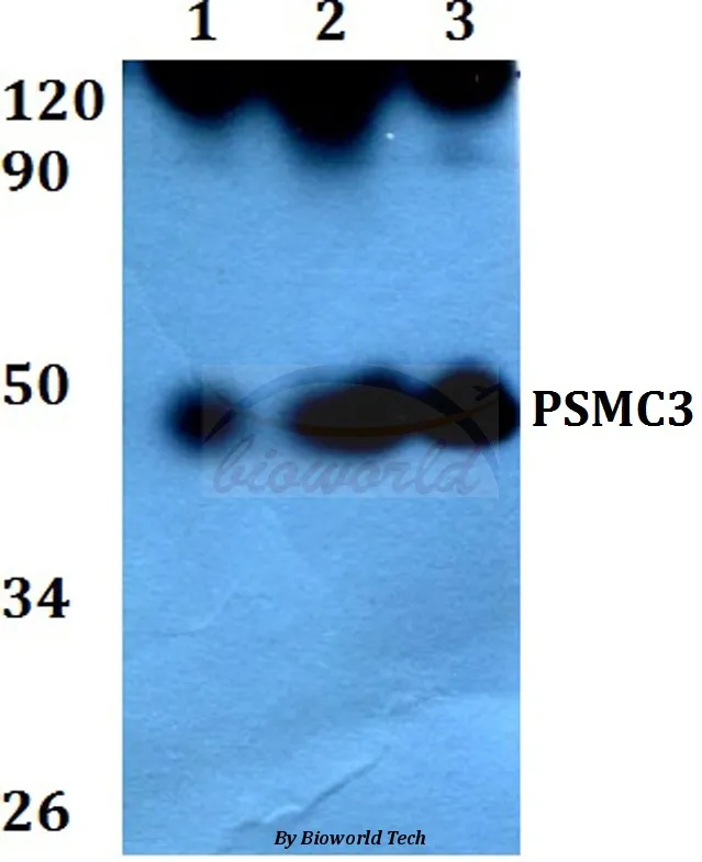 PSMC3 Rabbit Polyclonal Antibody - image 1