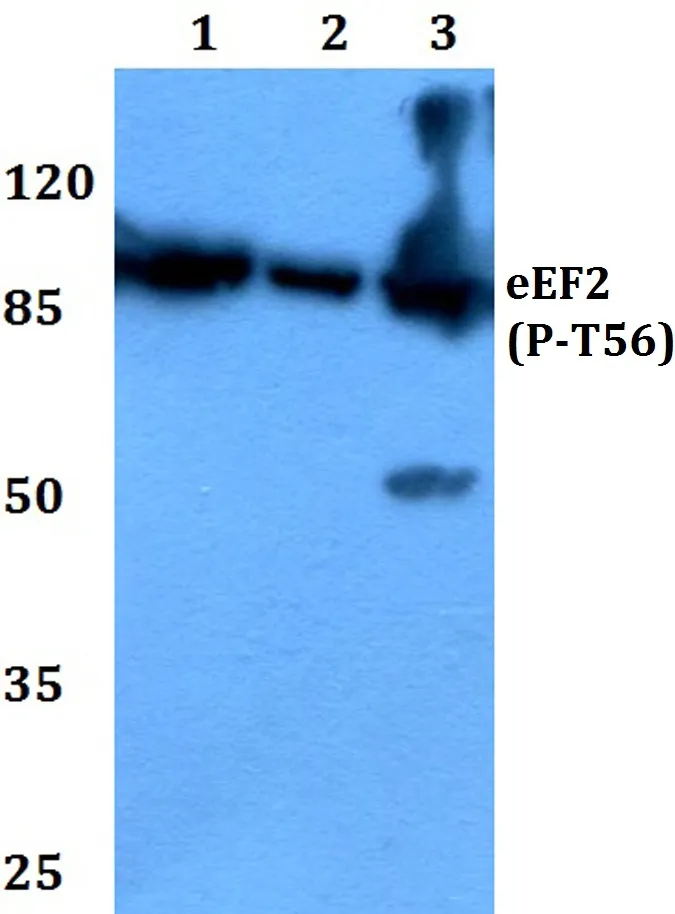 EEF2 Rabbit Polyclonal Antibody - image 1