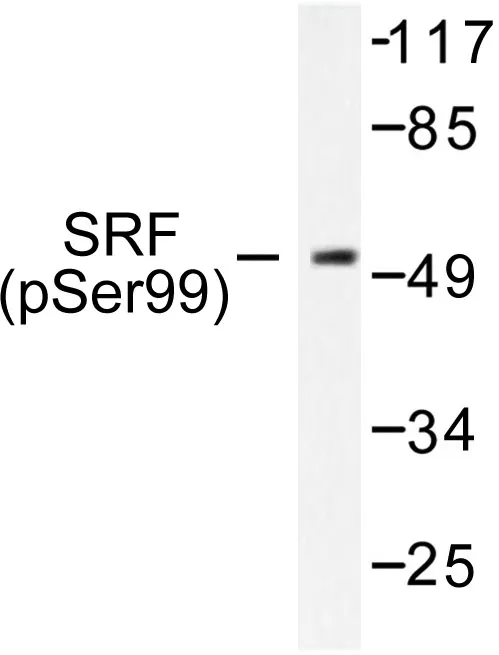 Serum Response Factor (SRF) Rabbit Polyclonal Antibody - image 1