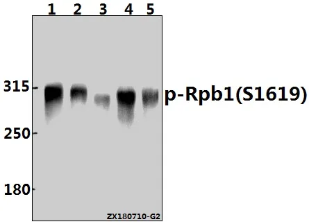 POLR2A Rabbit Polyclonal Antibody - image 1