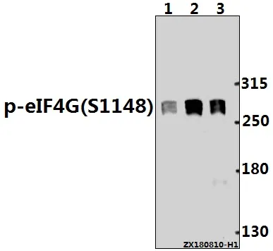 EIF4G1 Rabbit Polyclonal Antibody - image 1