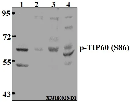 KAT5 Rabbit Polyclonal Antibody - image 1