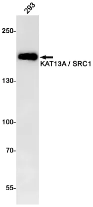 NCOA1 Rabbit Monoclonal Antibody [Clone ID: R07-5B7] - image 1