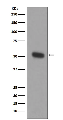Tryptophan Hydroxylase (TPH1) Rabbit Monoclonal Antibody - image 1