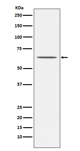 Nogo Receptor (RTN4R) Rabbit Monoclonal Antibody - image 1