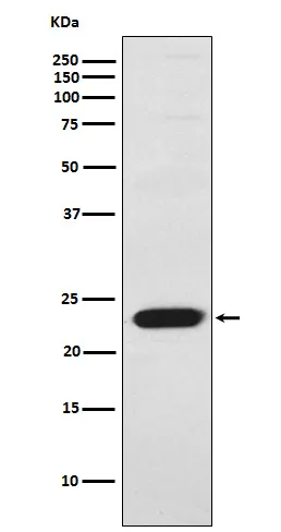 Troponin I fast skeletal muscle (TNNI2) Rabbit Monoclonal Antibody - image 1