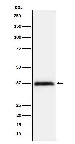 Repulsive Guidance Molecule A (RGMA) Rabbit Monoclonal Antibody - image 1