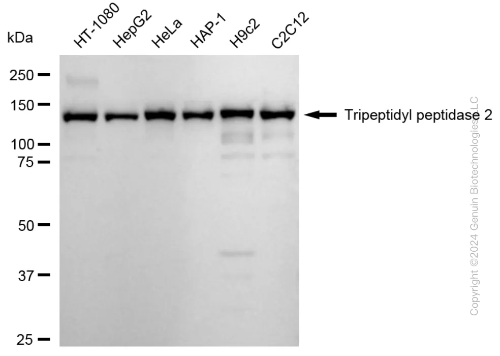 TPP2 Rabbit Monoclonal Antibody [Clone ID: 24GB2015] - image 1
