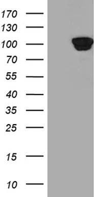 PYGM Mouse Monoclonal Antibody (HRP conjugated) [Clone ID: OTI3C11] - image 1