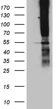 TM4SF2 (TSPAN7) Mouse Monoclonal Antibody (Biotin conjugated) [Clone ID: OTI2D6] - image 1