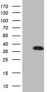DLX1 Mouse Monoclonal Antibody (HRP conjugated) [Clone ID: OTI1A2] - image 1