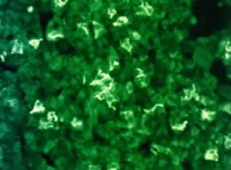 beta Endorphin Rabbit Polyclonal Antibody - image 1