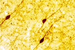 VIP Rabbit Polyclonal Antibody - image 1
