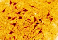 Serotonin Rabbit Polyclonal Antibody - image 1