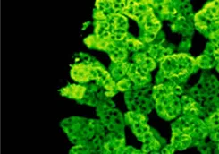 Chromogranin A (CHGA) Rabbit Polyclonal Antibody - image 1