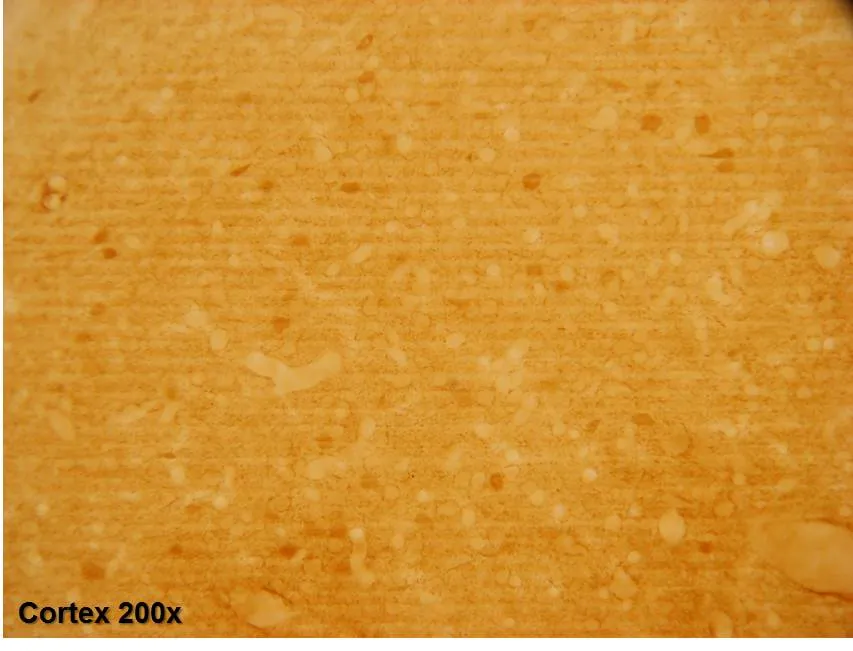 GABA Rabbit Polyclonal Antibody - image 1