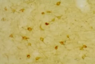 5 HT 2A (HTR2A) Rabbit Polyclonal Antibody - image 1