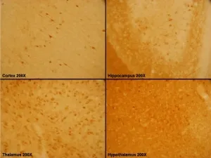 Calbindin (CALB1) Rabbit Polyclonal Antibody - image 1