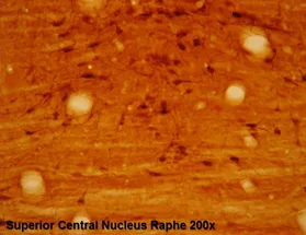 5-Hydroxytryptophan / 5HTP Rabbit Polyclonal Antibody - image 1