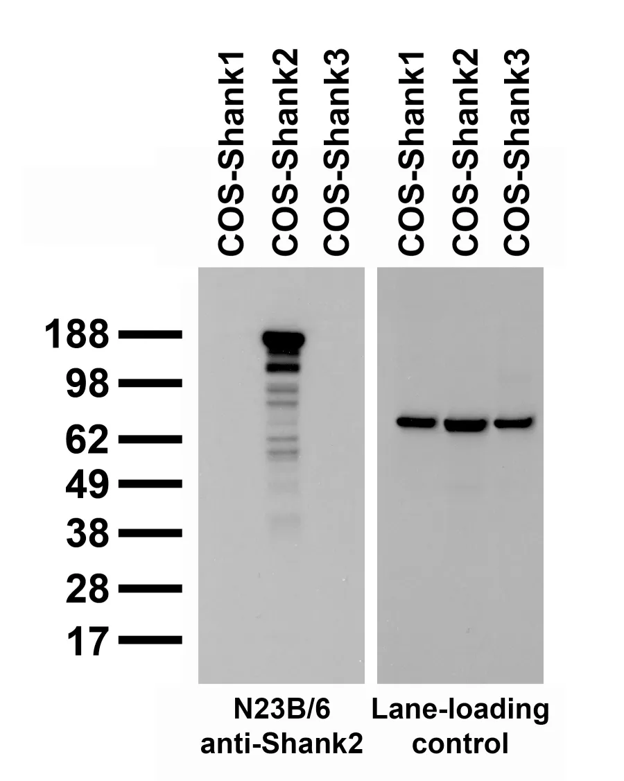 Shank2 Mouse Monoclonal Antibody [Clone ID: N23B/6] - image 1