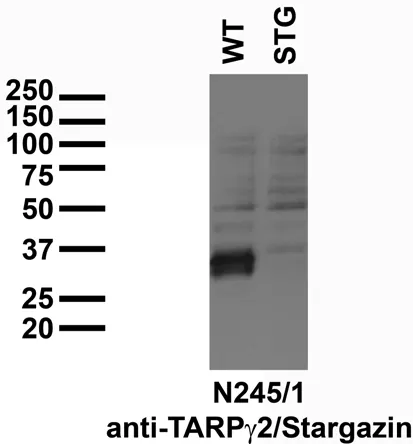 CACNG2 Mouse Monoclonal Antibody [Clone ID: N245/1] - image 1