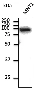 beta Catenin (CTNNB1) Goat Polyclonal Antibody - image 1