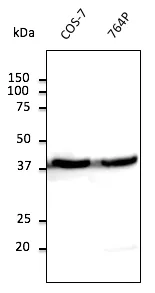 beta Actin (ACTB) Goat Polyclonal Antibody - image 1