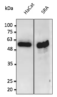 p53 (TP53) Goat Polyclonal Antibody - image 1