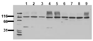 FAK (PTK2) pTyr397 (incl. pos. control) Mouse Monoclonal Antibody [Clone ID: 2D11] - image 1