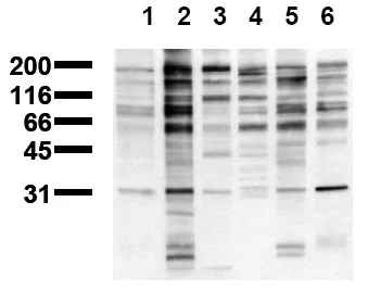Phosphotyrosine (pYpY Motif) (incl. pos. control) Mouse Monoclonal Antibody [Clone ID: 9F1] - image 1