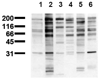 Phosphotyrosine (incl. pos. control) Mouse Monoclonal Antibody [Clone ID: 16F4] - image 1