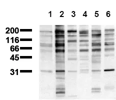 Phosphotyrosine 7x sampler kit (incl. pos. control) Mouse Polyclonal Antibody - image 1