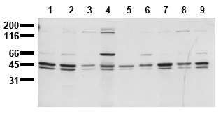 SHC (SHC1) (C-term) (incl. pos. control) Mouse Monoclonal Antibody [Clone ID: 11F6] - image 1