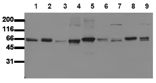 SHC (SHC1) (N-term) (incl. pos. control) Mouse Monoclonal Antibody [Clone ID: 24E4] - image 1