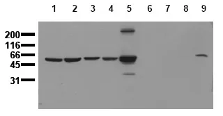 Vimentin (VIM) (incl. pos. control) Mouse Monoclonal Antibody [Clone ID: 11H6] - image 1