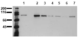 beta Catenin (CTNNB1) (dephospho 27-37) (incl. pos. control) Mouse Monoclonal Antibody [Clone ID: 8E4] - image 1