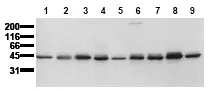 TPTEP2-CSNK1E (incl. pos. control) Mouse Monoclonal Antibody [Clone ID: 4D7] - image 1