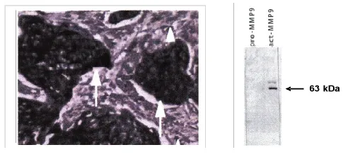 MMP9 (Active Protein) Mouse Monoclonal Antibody [Clone ID: 4A3] - image 1
