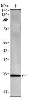 Interferon gamma (IFNG) Mouse Monoclonal Antibody [Clone ID: 3F1E3] - image 1