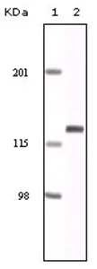 Eph receptor A2 (EPHA2) Mouse Monoclonal Antibody [Clone ID: 1B3C7] - image 1